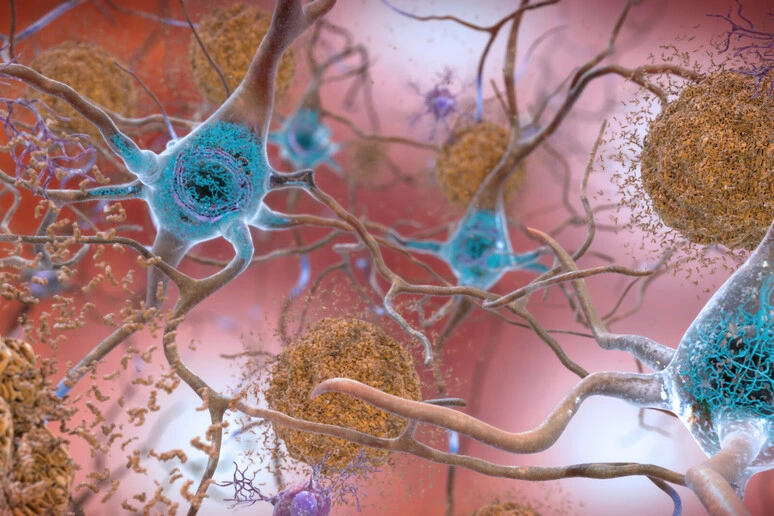 La proteina chiave dell'Alzheimer si propaga attraverso i neuroni