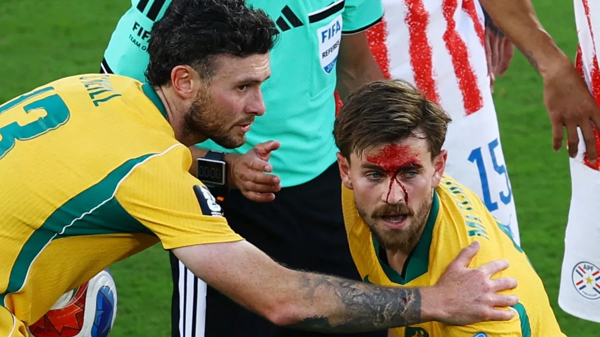 WM 2026: Fieser Tritt ins Gesicht: Blut-Schock für Bundesliga-Star