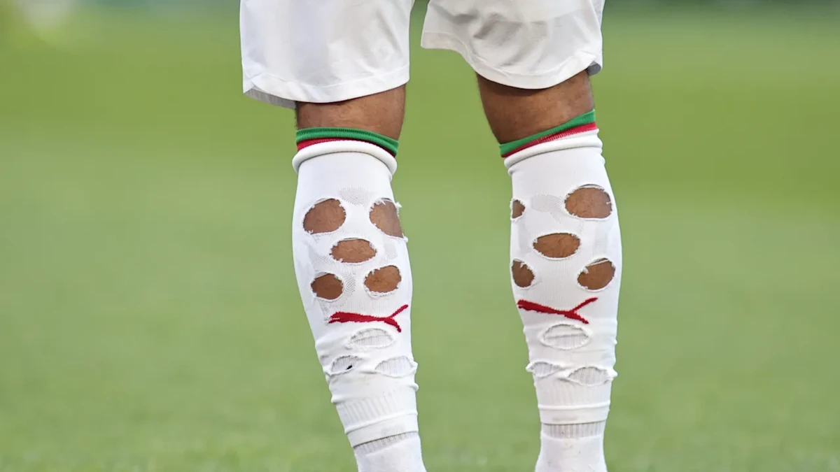 WM 2026: Warum schneiden Fußballer ihre Stutzen auf?