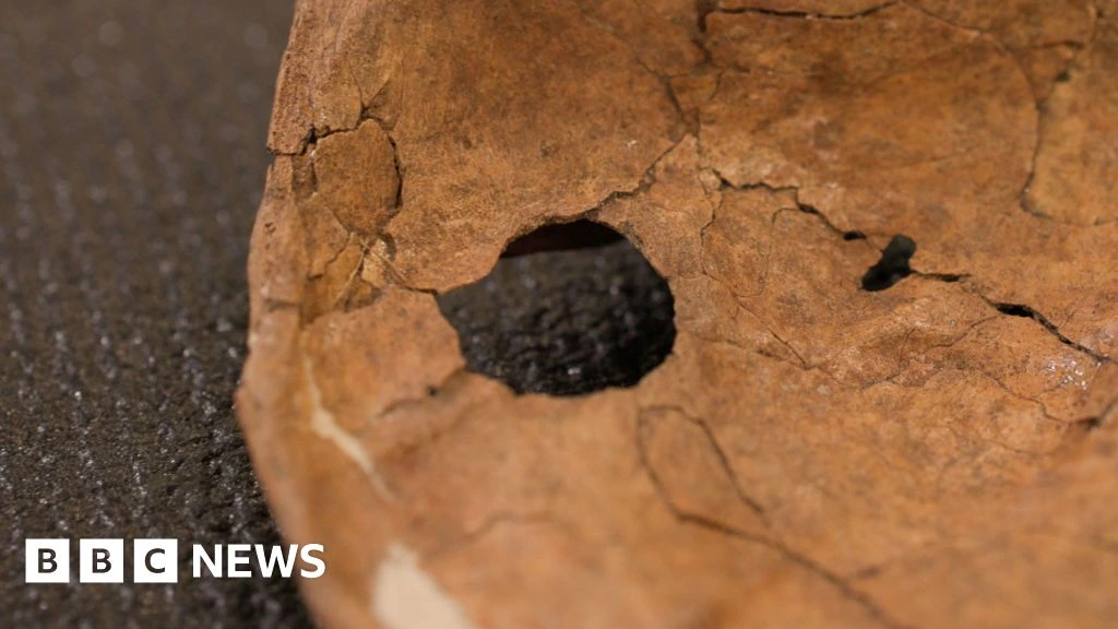Was Neanderthal life violent? This wound suggests lethal fighting was more common