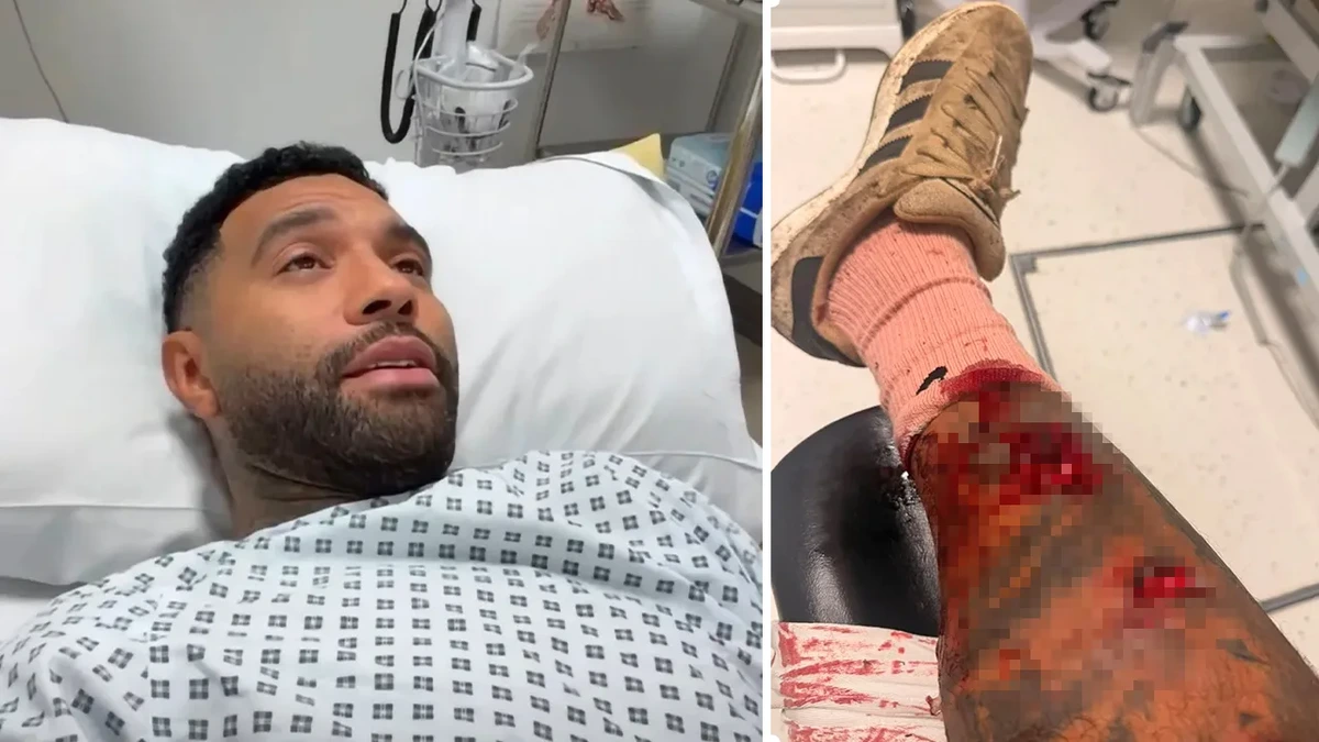 Premier League: Ex-Star hat heftige Bisswunden nach Attacke von Hund